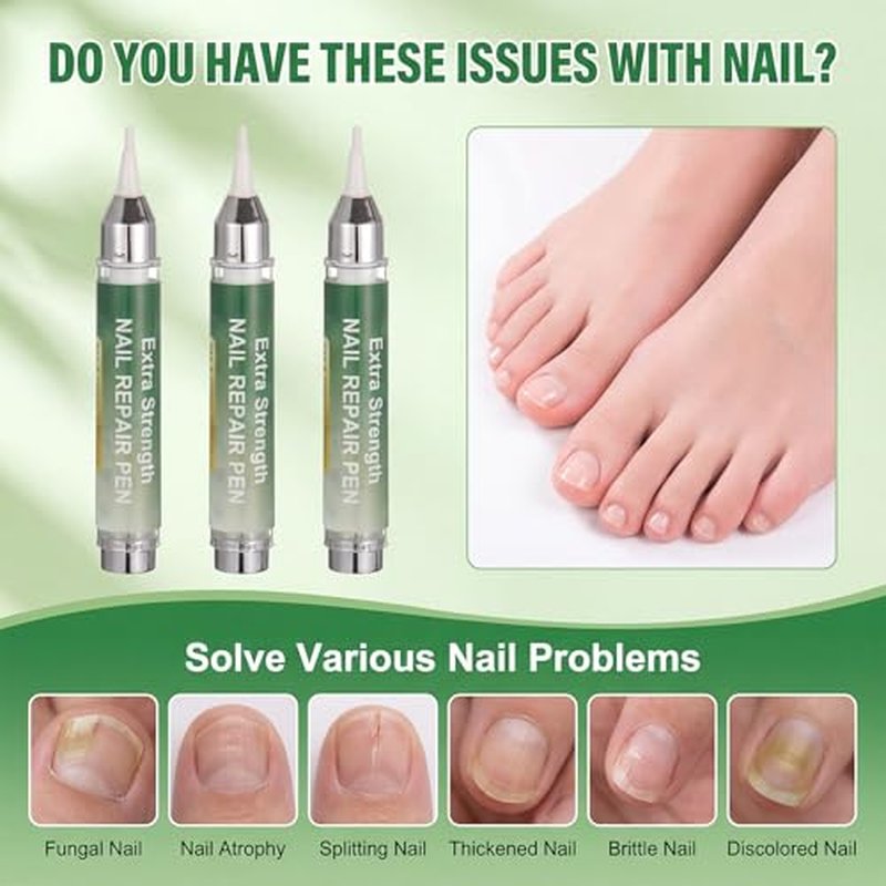 Toenail Treatment Pen 3-Pack, 16ml, 25% Undecylenic Acid