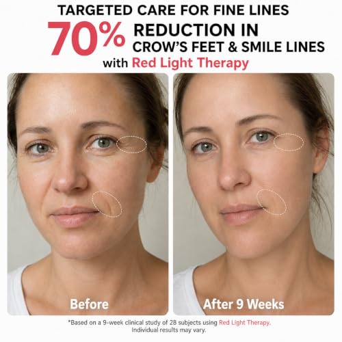 Red Light Therapy LED Face Mask for Acne & Fine Lines