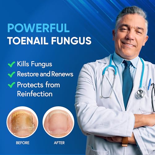 Extra Strength Toenail Fungus Treatment with 25% Undecylenic Acid & Tea Tree Oil - 2 Pcs