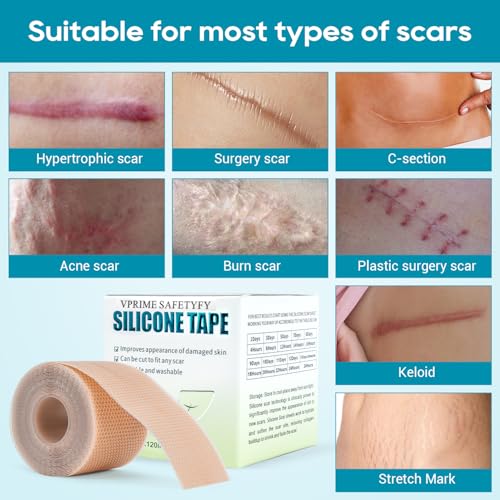 Silicone Scar Tape, Silicone Scar Sheets for Surgical Scars (1.6"x 80" Roll-2M), Medical Ggrade Scar Tape for Scars, Keloid, Acne Scars, Burn, C-Section, Stretch Marks Scars Away