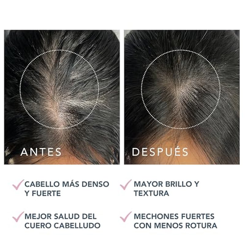 FOREO LUNA Dual-Peptide Scalp Serum - Hair Growth & Thickening Treatment