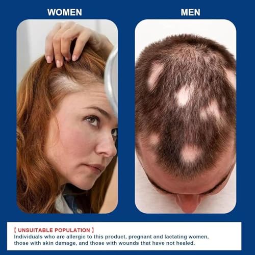 5% Minoxidil Hair Growth Cream for Men & Women