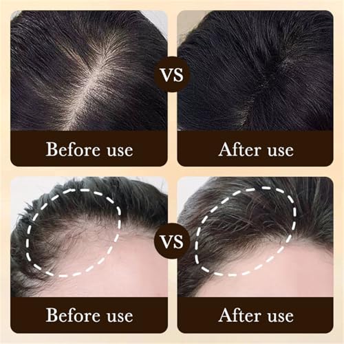 2-Deoxy-D-Ribose Hair Growth Serum 60ml