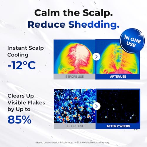 EPAIS Scalp Boosting Serum 150ml with 38-Tip Comb Applicator