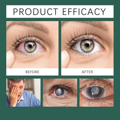 Optifusion Eye Drops with Lutein & Vitamins C/E - 2pcs
