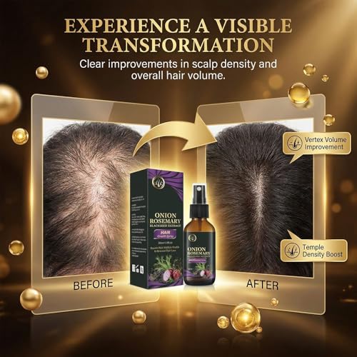 Onion Oil Hair Growth Serum with Rosemary & Black Rice