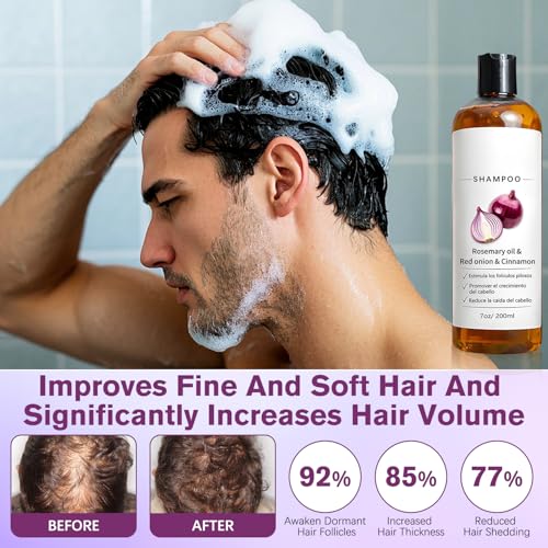 Onion Shampoo with Rosemary Oil & Biotin for Hair Loss, 7oz