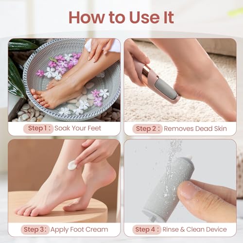 ZABOUL Electric Foot Callus Remover with 2 Roller Heads