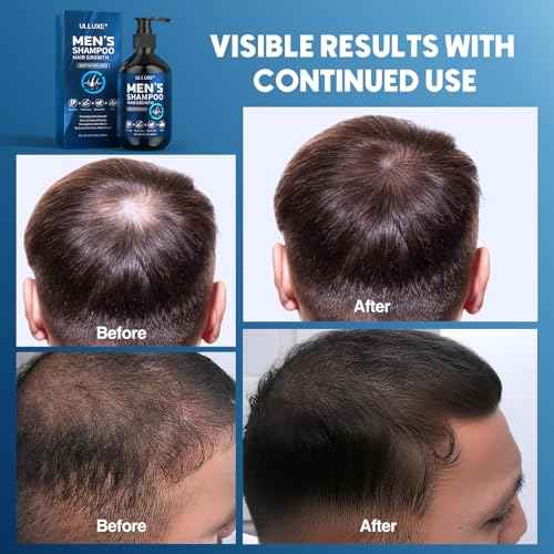 Biotin Hair Growth Shampoo for Men: Natural Mens Thickening Shampoo for Hair Loss and Thinning Hair, Infused Rosemary Oil Tea Tree Oil and Mint, Sulfate Free and Color Safe, 10.15 fl.oz