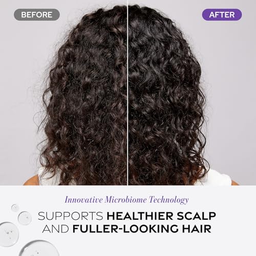 Dr. Groot Scalp Exfoliating Detox Water – Hair Loss, Sebum Control