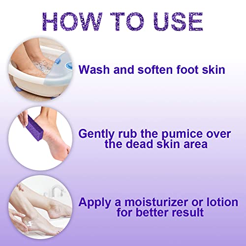 40 PCS Foot Pumice Stone Set - Professional Callus Remover for Smooth Feet