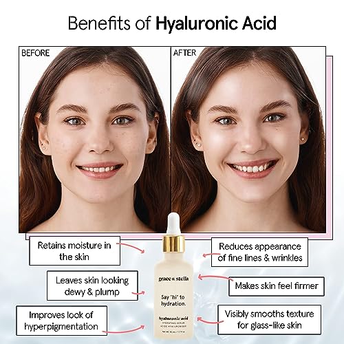 grace & stella Award Winning Hyaluronic Acid Serum (10ml/0.34 fl oz) Hyaluronic Acid Serum for Face - Acido Hialuronico Face Serums for Women - Hydrating, Remove Fine Lines, Wrinkles - Anti Aging