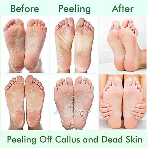 5 Pack Foot Peeling Mask for Soft, Exfoliated Feet - Lavender & Aloe