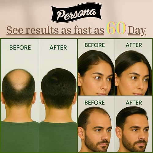 Persona Beauty Hair Growth Serum with Biotin & Caffeine - 30ml