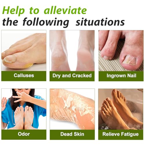 Epsom Salt Foot Soak with Tea Tree Oil - 16 oz for Athletes Foot & Calluses