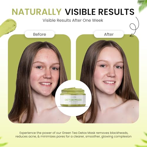 Teami Green Tea Detox Face Mask - Acne & Blackhead Remover