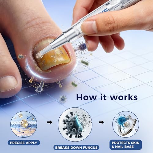 FSA/HSA Toenail Fungus Treatment Pen 25% Undecylenic Acid