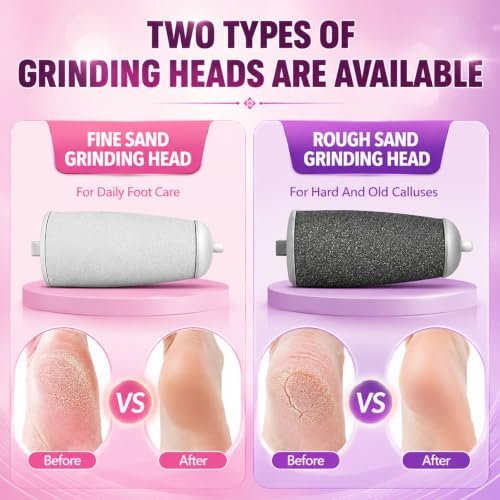 MUSICRAB Electric Callus Remover - Rechargeable Foot File with 2 Speeds & 2 Grinding Heads