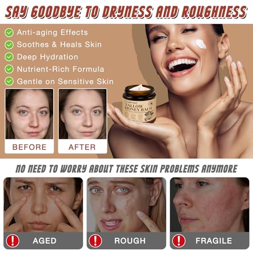 Beef Tallow for Skin,Beef Tallow for Face,Beef Tallow and Honey Balm,Grass Fed Whipped Tallow Honey Balm,Natural Moisturizer Hydrates,Deeply Nourishes the Skin, Enhances Natural Radiance