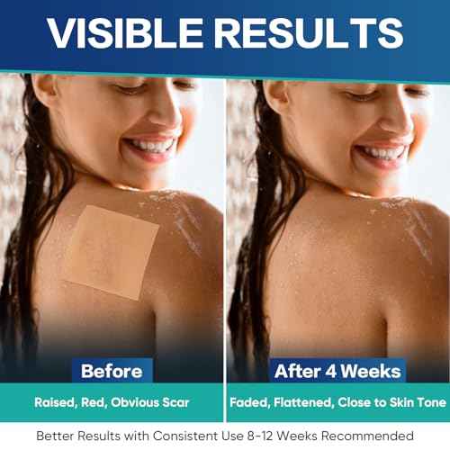 Medical Grade Silicone Scar Sheets, 20 Count (10x4 x4+10x1.2 x6) Dual-Size Scar Treatment for Surgical, Burn, Hypertrophic & Keloid Scars, Breathable & Discreet Strips