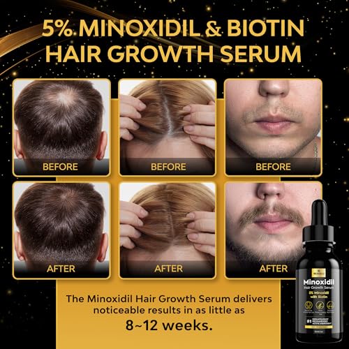 5% Minoxidil Hair & Beard Growth Treatment for Men & Women - 1oz