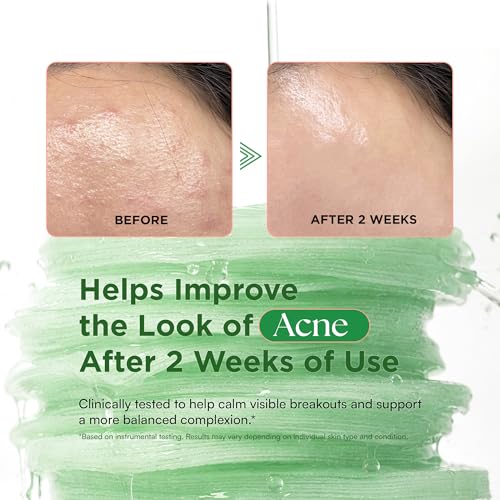 Matcha Face Toner Pads for Dark Spots, Acne-Prone & Dull Skin, Hydrating Facial Toning Polish Pad Recovery & Refining with Rose PDRN, Peptides & Hyaluronic Acid, Korean Skin Care, 100 Pads (1 Pack)