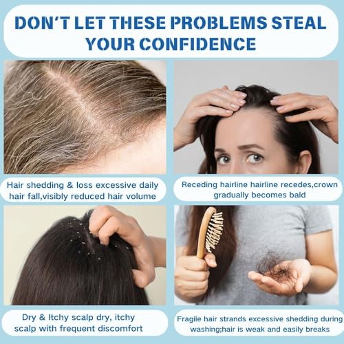 5% Hair Growth Scalp Cream with Biotin & Rosemary – 2 PC, Nourishing Anti-Hair Loss