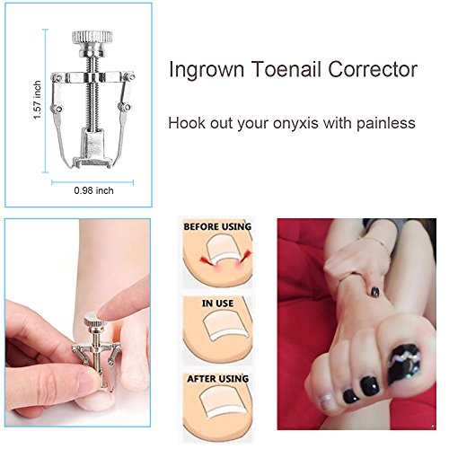 Ingrown Toenail Tools Kit - 10 Pcs Professional Pedicure Set