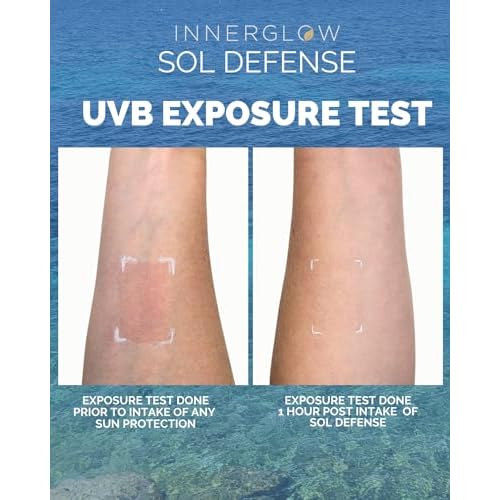 Sol Defense Gummies ? Dermatologist & Plastic Surgeon-Formulated Skin Resilience Vitamin Supplement with Polypodium Leucotomos & Niacinamide, Passion Fruit Flavor, 60 Sugar-Free Gummies