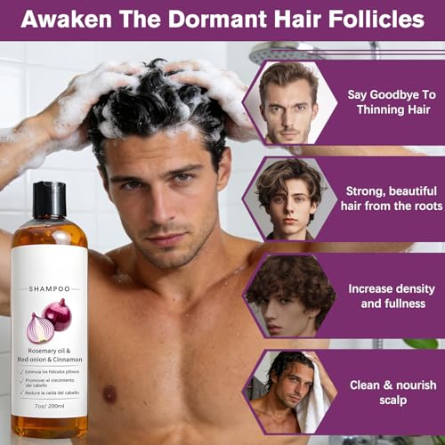 Onion Shampoo with Rosemary Oil & Biotin for Hair Loss, 7oz