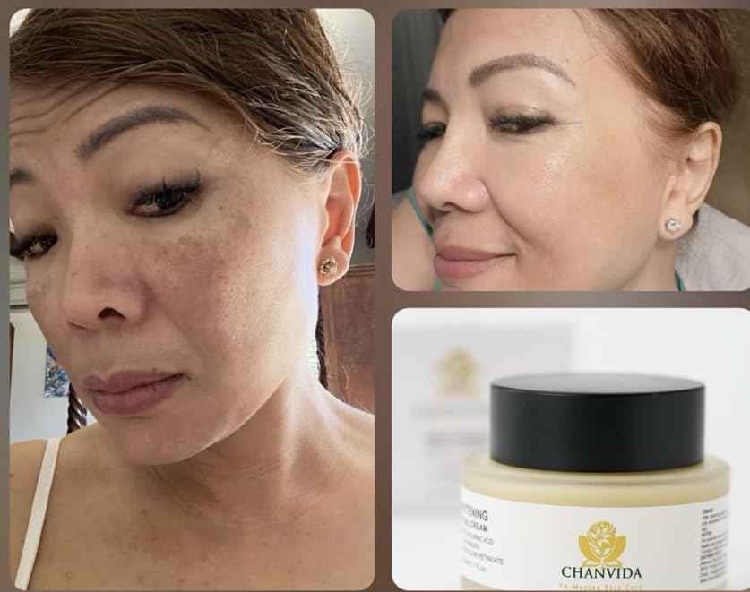 CHANVIDA Whitening Facial Cream 3-OETHYL Ascorbic Acid, Niacinamide, Hydoxypinacolone Retinoate, Ceramides, Plus Natural Ingredients Reduce Hyperpimentation, Dark Spots, Enlarged Pores & Fine Lines.
