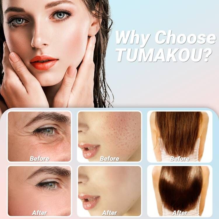TUMAKOU High Frequency Facial Wand with 6 Glass Tubes