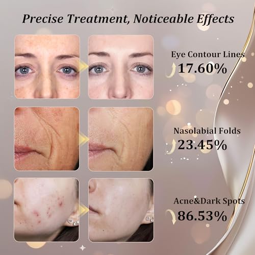 CUEME Red Light Therapy Mask - FDA-Cleared LED for Wrinkles & Acne