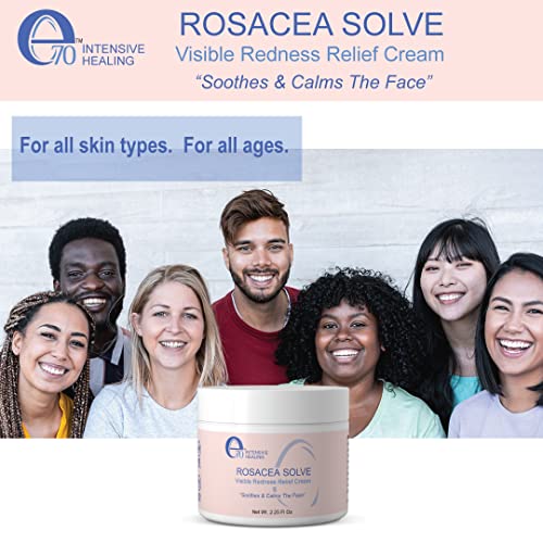 e70 Rosacea Solve - Redness Relief Cream - Face Moisturizer For Rosacea & Acne Prone Skin - Sensitive Skin Care With Organic Ingredients, Almond Oil, Licorice & Chamomile Extracts - No Parabens