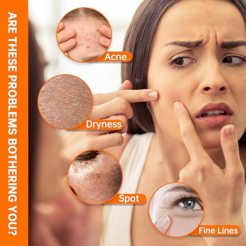 Niacinamide 10% + Zinc 1% Serum, Anti-Aging Niacinamide Serum for Face, 1PCS Moisturizing Facial Serum for All Skin Type, Women Face Skin Care.