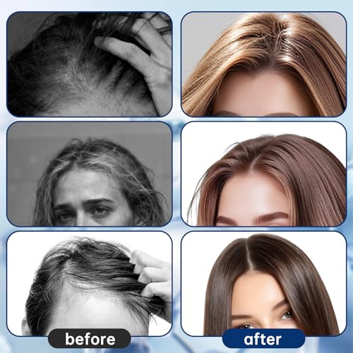 Botanical Hair Serum Roll-On for Thinning Hair with Rosemary & Redensyl
