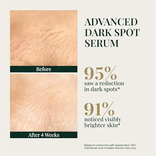 E'Luxxe Clinical Hyperpigmentation & Dark Spot Serum ? Tranexamic Acid, Niacinamide & Vitamin C ? For Face & Body, Post-Acne & Dark Scar Marks ? Fragrance-Free 50ml