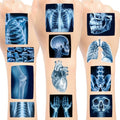 X Ray Temporary Tattoo Stickers - 24 Sheets Radiology Party Favors