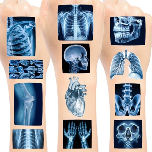 X Ray Temporary Tattoo Stickers - 24 Sheets Radiology Party Favors