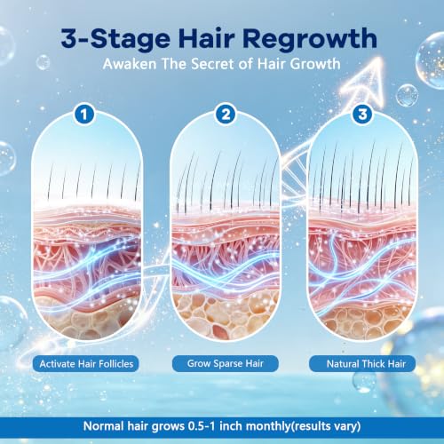 Men's 5% Minoxidil Foam with Biotin - Hair & Beard Growth