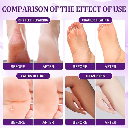 4-Step Lavender Pedicure Kit - Foot Spa Set with Soak, Scrub & Lotion