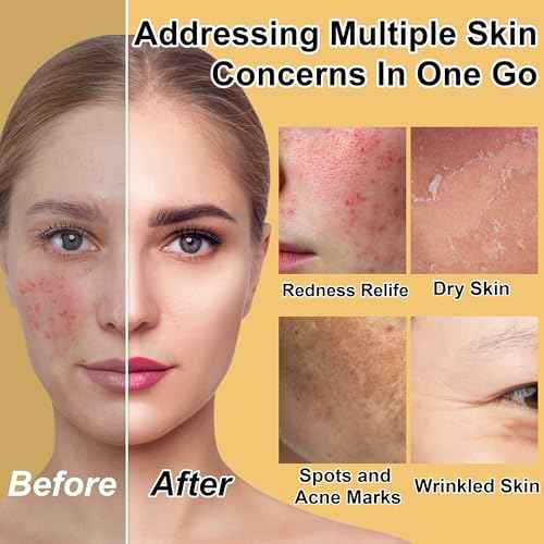 Skin Care Set for Teens Women,Anti-Aging Deeply Hydrates Repairs Skincare Gift Set for All Skin,Facial Skin Care Products Routine Kit Christmas Beauty Gift Set for Women