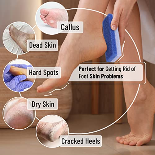 Natural Pumice Stone Foot Callus Remover 4 Pack for Exfoliation
