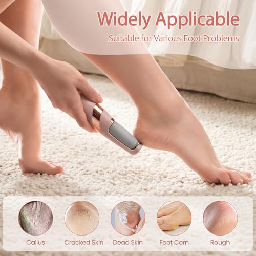 ZABOUL Electric Foot Callus Remover with 2 Roller Heads
