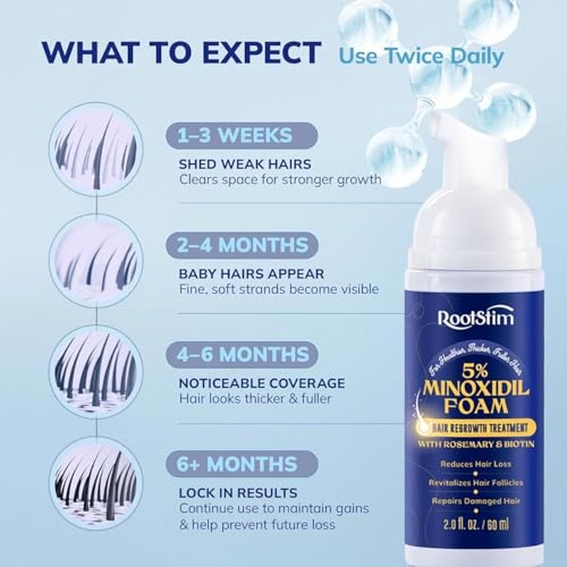RootStim 5% Minoxidil Foam for Hair Loss & Regrowth