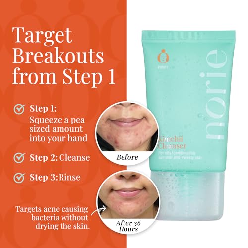 Norie Kimchii Face Wash - Gentle Facial Cleanser for Dry, Oily & Sensitive Skin | Fragrance Free Gel for Clearer Skin 2% Salicylic Acid, Vegan, Unscented 1.7oz