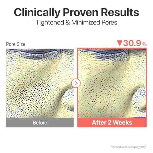 numbuzin No.3 Serum | Skin Softening Serum | Pores, Textured, Bumpy, Rough to Glass Skin | Bifida, Galactomyces, Niacinamide, Adenosine, Panthenol | 1.69 fl. oz.