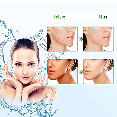 300 ML Aloe Vera Gel ? 99% Organic Pure Aloe Vera Hydrating Moisturizer, Natural Aloe Cream for Dry Skin, Sunburn, Acne