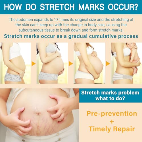 PEGO Stretch Mark Butter for Pregnancy,Women Belly Butter,Shea Butter,Maternity Stretch Mark Cream,Massages Body & Reduces Scar Appearance, Postpartum Care for Moms,Hypoallergenic100g/3.53oz