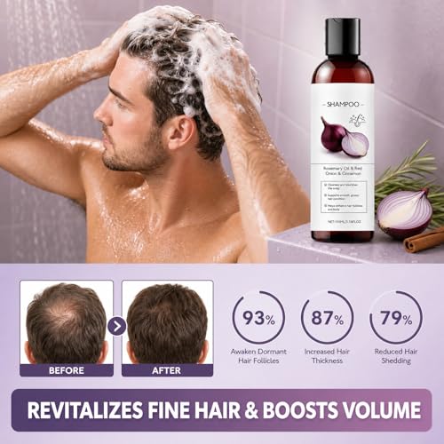 Onion Shampoo for Hair Growth - Anti Hair Loss Treatment